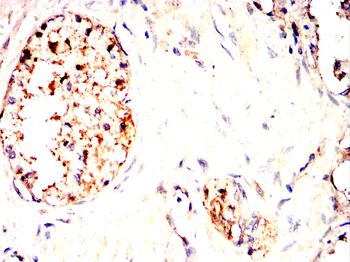 PRDX1 Antibody
