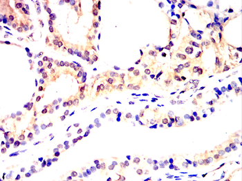 PRDX1 Antibody