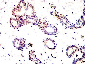 PRKN Antibody