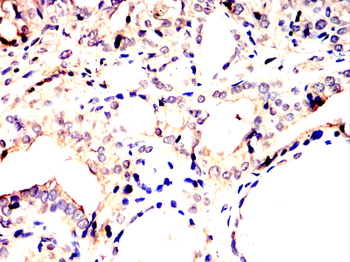 PRKN Antibody