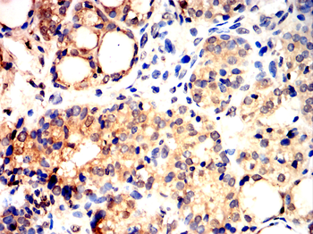 TGFA Antibody