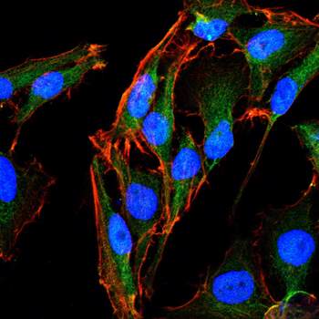 RICTOR Antibody