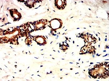 RICTOR Antibody