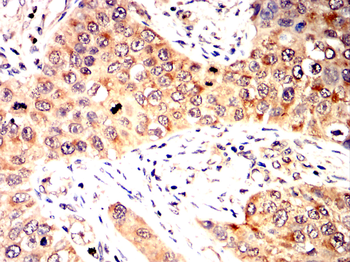 RICTOR Antibody