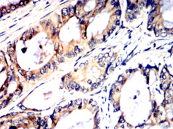 RICTOR Antibody