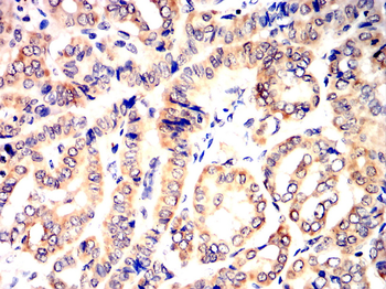 RICTOR Antibody