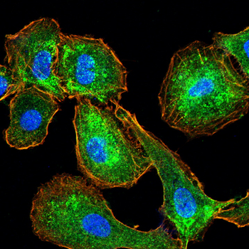 IL-6 Antibody