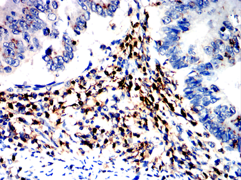 PTPRC Antibody
