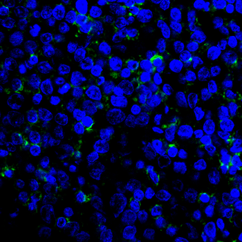 PTPRC Antibody