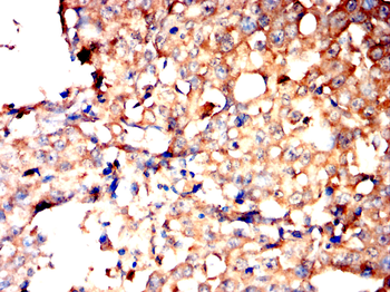 STMN1 Antibody