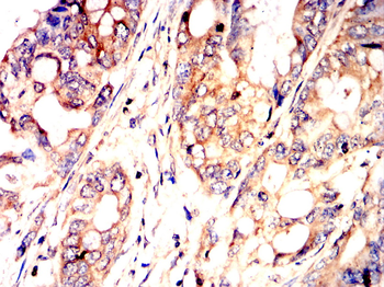 STMN1 Antibody