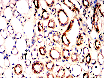 STMN1 Antibody