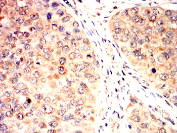 STMN1 Antibody