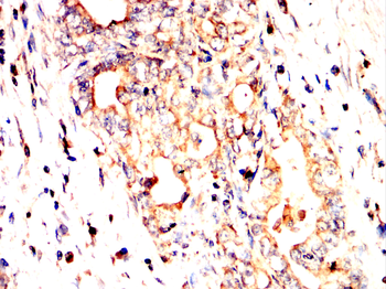 STMN1 Antibody