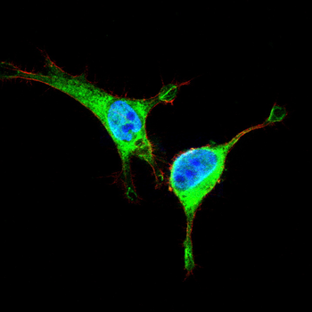 GSTP1 Antibody