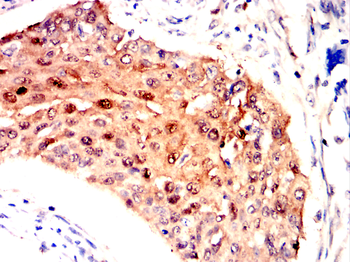 GSTP1 Antibody