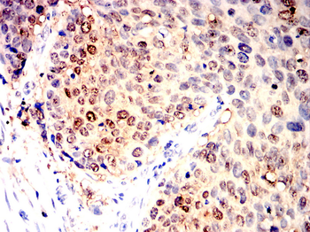 GSTP1 Antibody