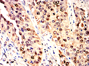 GSTP1 Antibody