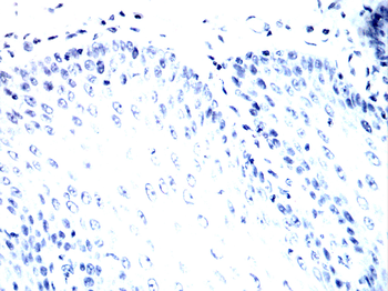 Hemgglutinin Gene Antibody