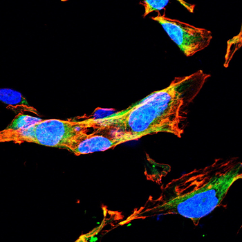 CCR2 Antibody