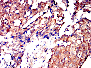 CCR2 Antibody