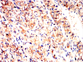 CCR2 Antibody