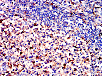 CCR2 Antibody