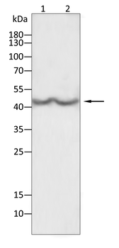 CCR2 Antibody