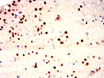 BDNF Antibody