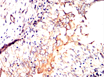 BMPR1A Antibody