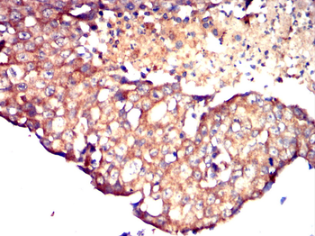BMPR1A Antibody