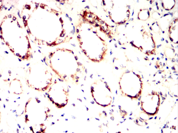 BMPR1A Antibody