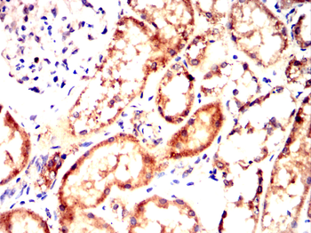 BMPR1A Antibody