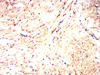 BMPR1A Antibody