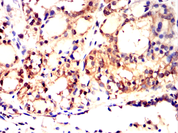 BMPR1A Antibody
