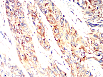 IFNAR1 Antibody