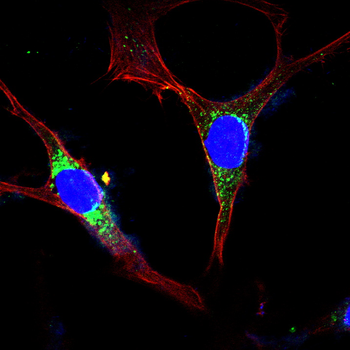 TSG101 Antibody