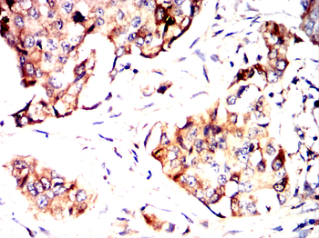 TSG101 Antibody