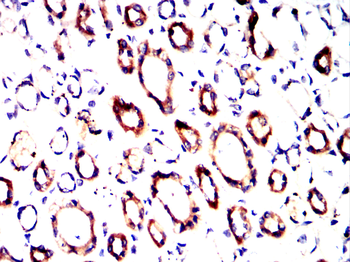 TSG101 Antibody