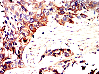 TSG101 Antibody