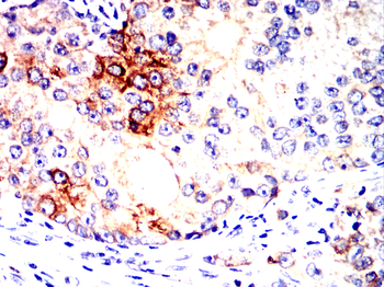 TSG101 Antibody