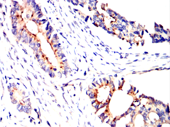 TSG101 Antibody