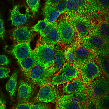SMAD4 Antibody