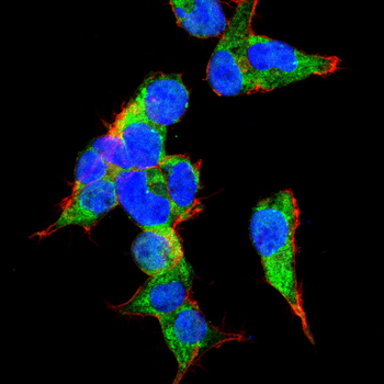 SMAD4 Antibody
