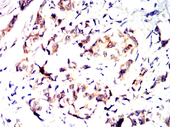 WFDC2 Antibody