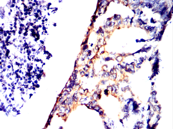 WFDC2 Antibody