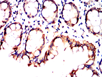 WFDC2 Antibody