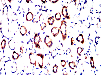WFDC2 Antibody