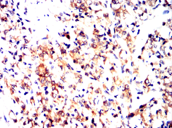 WFDC2 Antibody