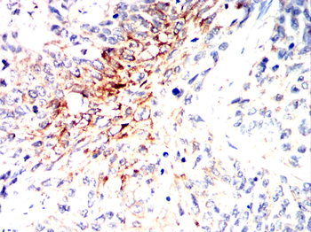 GRIN1 Antibody